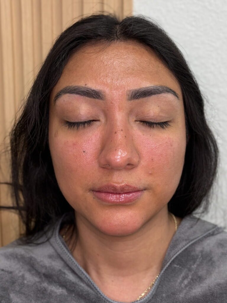 Face balance with plasma gel