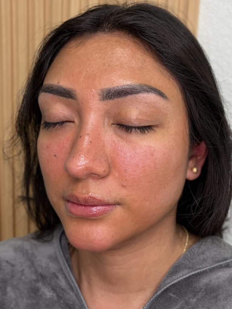 Face balance with plasma gel